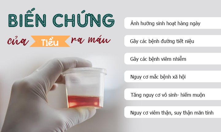 Tiểu ra máu có tự khỏi không? 6+ Trường hợp cần điều trị sớm