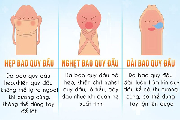 Nếu không cắt bao quy đầu dài có sao không?