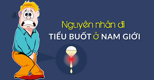 nguyen tieu buot o nam gioi.png