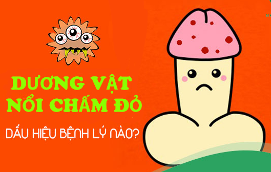 chấm đỏ bqđ.jpg